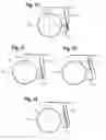 Fig. 06 - Receiving part for receiving a rod for coupling the rod to a bone anchoring element and a bone anchoring device with such a receiving part