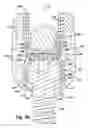 Fig. 05 - SPINAL FIXATION ASSEMBLY