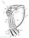 Fig. 01 - Instruments for minimally invasive stabilization of bony structures