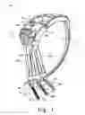 Fig. 02 - Instruments for minimally invasive stabilization of bony structures