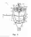 Fig. 04 - Instruments for minimally invasive stabilization of bony structures