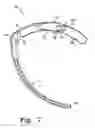 Fig. 07 - Instruments for minimally invasive stabilization of bony structures