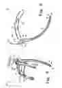 Fig. 08 - Instruments for minimally invasive stabilization of bony structures