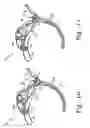 Fig. 09 - Instruments for minimally invasive stabilization of bony structures
