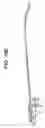 Fig. 14 - Insertion instrument for anteriorly inserting intervertebral spinal implants