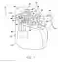 Fig. 02 - Implantable pulse generator EMI filtered feedthru