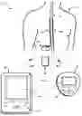 Fig. 01 - Impedance-based stimulation adjustment