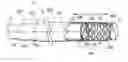 Fig. 01 - Over the endoscope introducer for stents