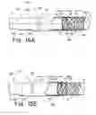 Fig. 13 - Over the endoscope introducer for stents