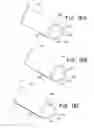 Fig. 15 - Over the endoscope introducer for stents