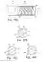 Fig. 16 - Over the endoscope introducer for stents