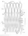 Fig. 01 - Stent and stent-graft having one or more conformance struts