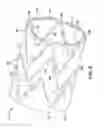 Fig. 06 - Stent and stent-graft having one or more conformance struts