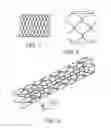 Fig. 02 - Stents with attached looped ends