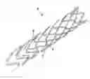 Fig. 01 - ENDOVASCULAR PROSTHESIS AND RELATING MANUFACTURING PROCEDURE