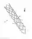 Fig. 02 - ENDOVASCULAR PROSTHESIS AND RELATING MANUFACTURING PROCEDURE