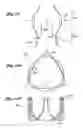 Fig. 09 - HOLDER FOR FLEXIBLE HEART VALVE