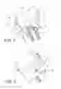 Fig. 03 - Shoulder prosthesis with vault-filling structure having bone-sparing configuration