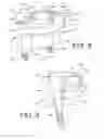 Fig. 06 - Shoulder prosthesis with vault-filling structure having bone-sparing configuration