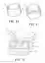 Fig. 07 - Shoulder prosthesis with vault-filling structure having bone-sparing configuration