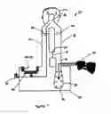 Fig. 02 - METHOD AND APPARATUS FOR VENTILATION ASSISTANCE