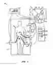 Fig. 02 - Sterile surgical adaptor