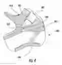 Fig. 05 - Zipper lubricating device