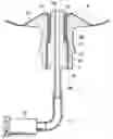 Fig. 01 - Pressure resistant container with sealed mouth entrance