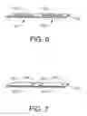 Fig. 07 - Remote detection systems for absorbent articles