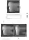 Fig. 07 - Apparatus for caries detection