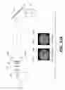 Fig. 28 - Apparatus for caries detection