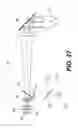 Fig. 34 - Apparatus for caries detection