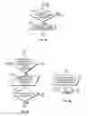 Fig. 06 - DUAL SCHEIMPFLUG SYSTEM FOR THREE-DIMENSIONAL ANALYSIS OF AN EYE
