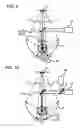 Fig. 06 - Light source