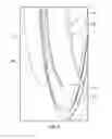 Fig. 04 - Radiation therapy and scanning system