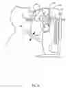 Fig. 11 - Orthovoltage radiotherapy