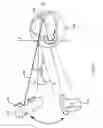 Fig. 13 - Orthovoltage radiotherapy