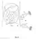 Fig. 42 - Orthovoltage radiotherapy