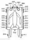 Fig. 01 - Noise reduction device