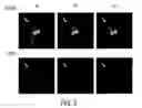 Fig. 09 - Probabilistic segmentation in computer-aided detection