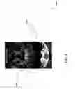 Fig. 04 - QUANTITATIVE SINGLE IMAGE-BASED MAGNETIZATION TRANSFER WEIGHTED IMAGING USING AN INTER-SUBJECT NORMALIZATION REFERENCE WITHIN THE IMAGE
