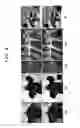 Fig. 09 - Methods of deblurring image and recording mediums having the same recorded thereon