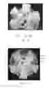Fig. 09 - Infiltration methods for forming drill bits