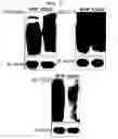 Fig. 06 - Method to inhibit cancer targeting CD24