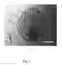 Fig. 02 - Colony-forming unit cell of human chorion and method to obtain and use thereof