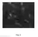 Fig. 06 - Colony-forming unit cell of human chorion and method to obtain and use thereof