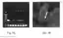 Fig. 08 - Colony-forming unit cell of human chorion and method to obtain and use thereof