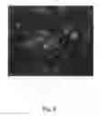 Fig. 09 - Colony-forming unit cell of human chorion and method to obtain and use thereof