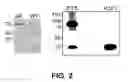Fig. 03 - METHOD OF DETECTING OCULAR DISEASES AND PATHOLOGIC CONDITIONS AND TREATMENT OF SAME