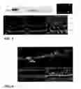 Fig. 06 - METHOD OF DETECTING OCULAR DISEASES AND PATHOLOGIC CONDITIONS AND TREATMENT OF SAME